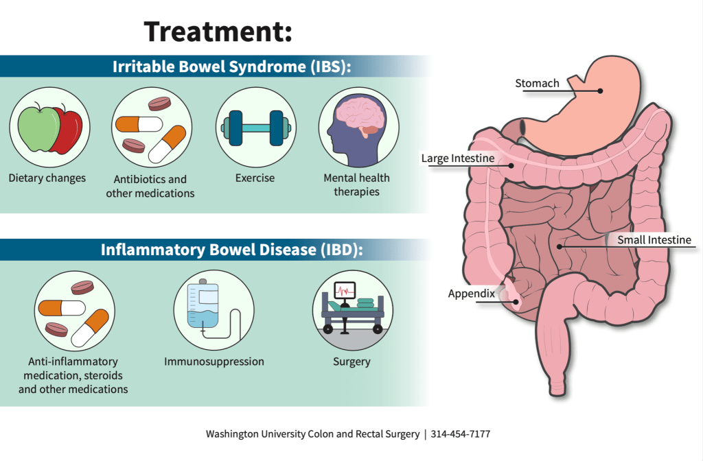 “Medical infographic showing IBS symptoms, types, and treatments with diagrams of intestines”