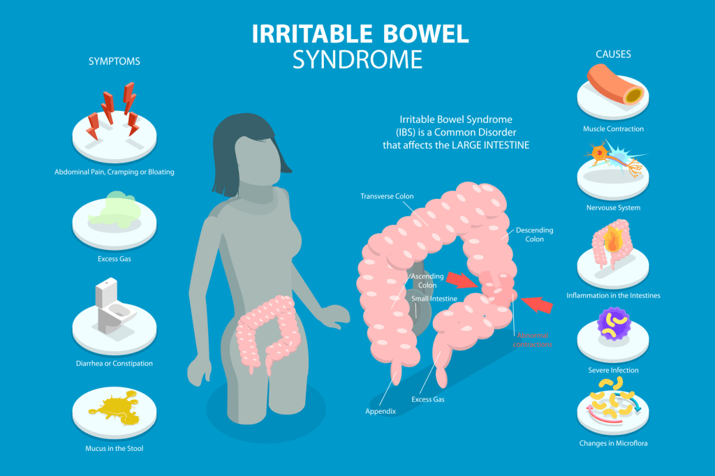 “Illustration representing Irritable Bowel Syndrome awareness with digestive system icon and colored background”
